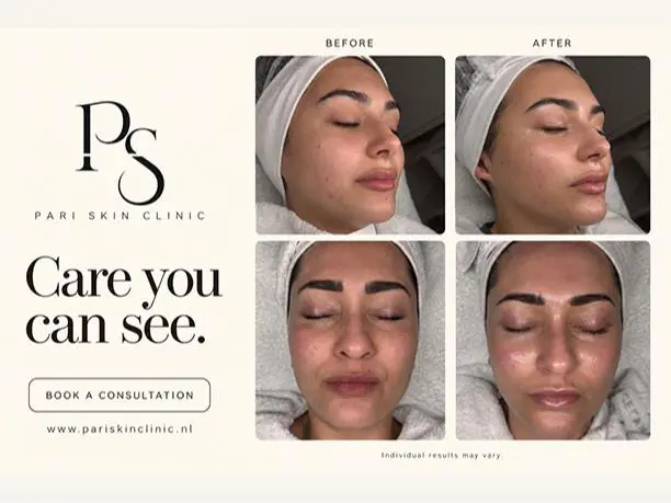 Pari Skin Clinic | کلینیک تخصصی پوست و زیبایی در روتردام