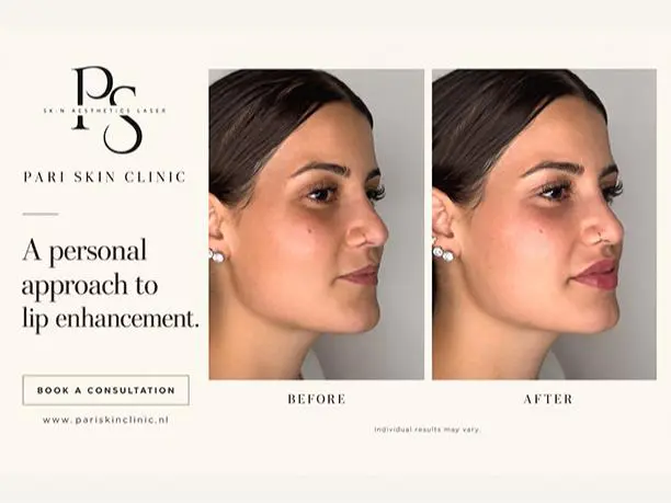 Pari Skin Clinic | کلینیک تخصصی پوست و زیبایی در روتردام